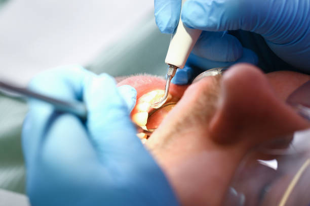 Best Emergency Orthodontic Repairs in Washington Court House, OH
